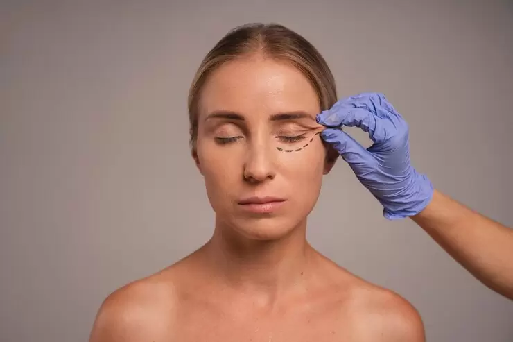 Blefaroplastika proseduru ilə gözlərinizi gənc və canlı görünüşə qovuşdurun. Estetik göz sağlamlığı üçün ideal seçimdir.